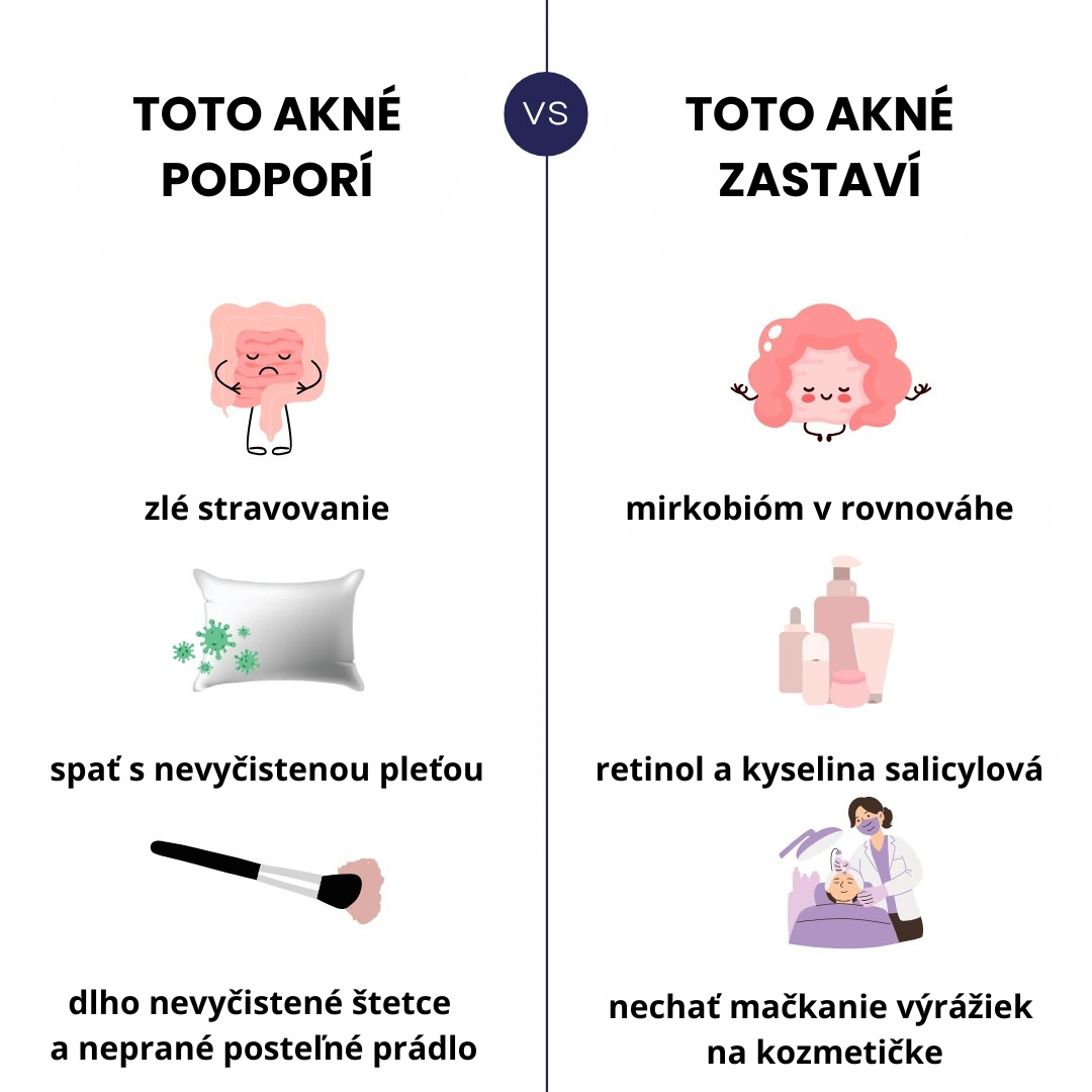 baner na článok (87)